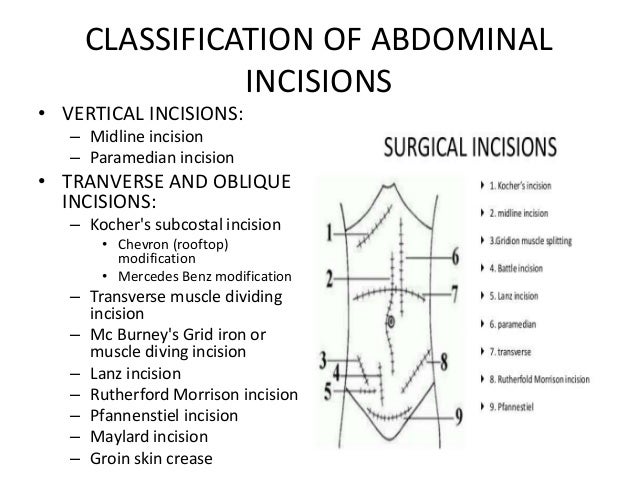 Anatomy of the anterior abdominal wall and incisions