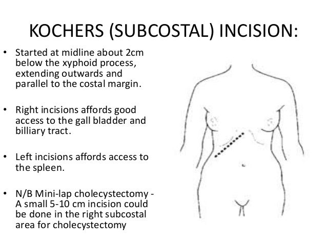 Abdominoplasty Incision Is On What Side Of The Body – TQXWT