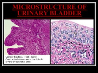 MICROSTRUCTURE OF
URINARY BLADDER
 