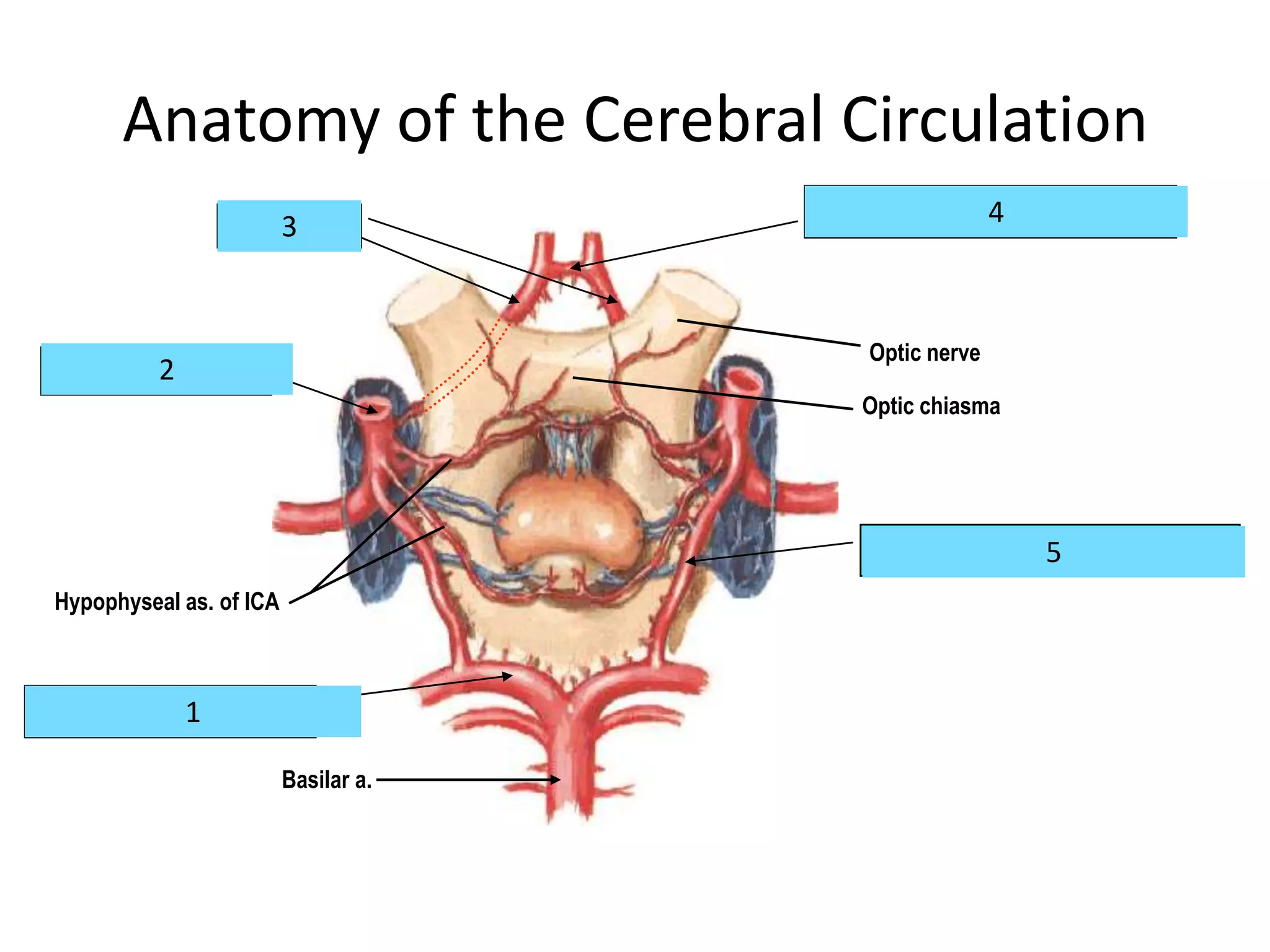 Anatomy of the Cerebral Circulation
A.C.A.
3
4
Anterior communicating a.
Optic nerve
2
Internal carotid a.
Optic chiasma
5
Posterior communicating a.
Hypophyseal as. of ICA
1
Posterior cerebral a.
Basilar a.