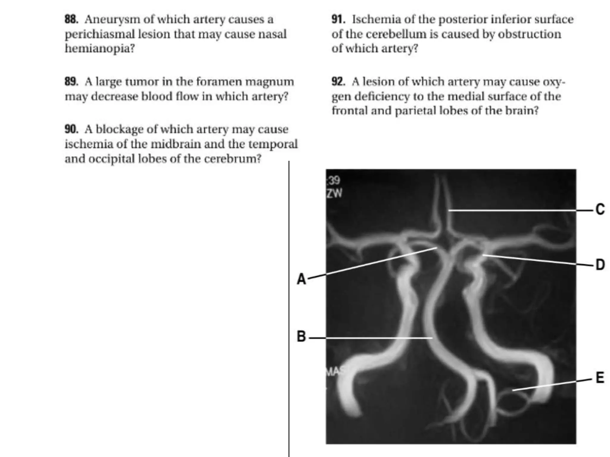 Anatomy of the cerebral circulation Week 5 objective
