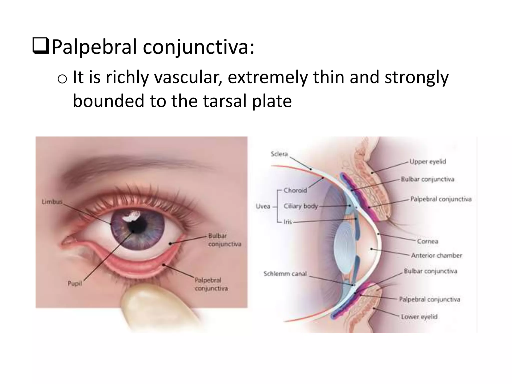 Palpebral conjunctiva:
o It is richly vascular, extremely thin and strongly
bounded to the tarsal plate
 