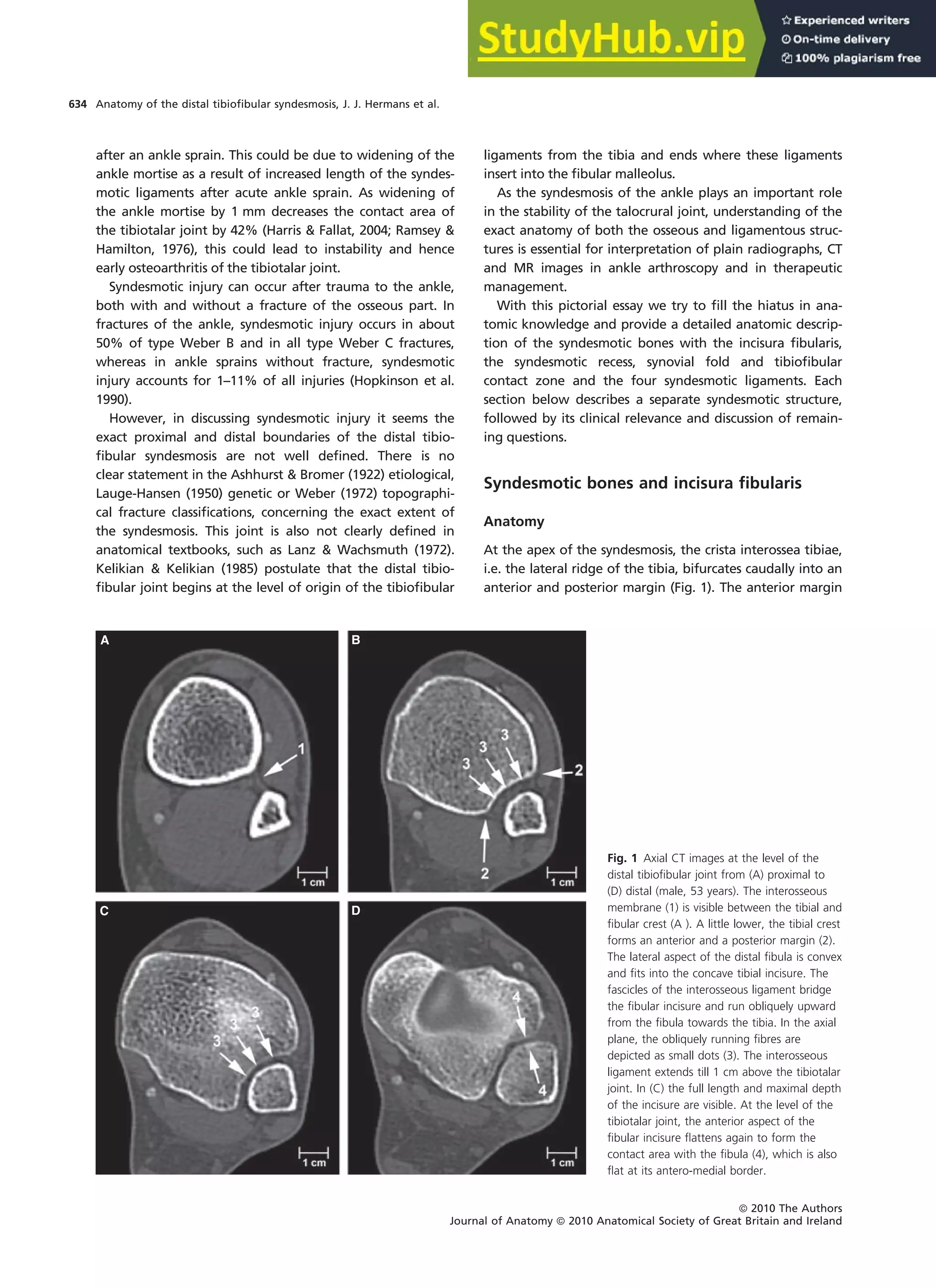 Anatomy Of The Distal Tibiofibular Syndesmosis In Adults A Pictorial ...
