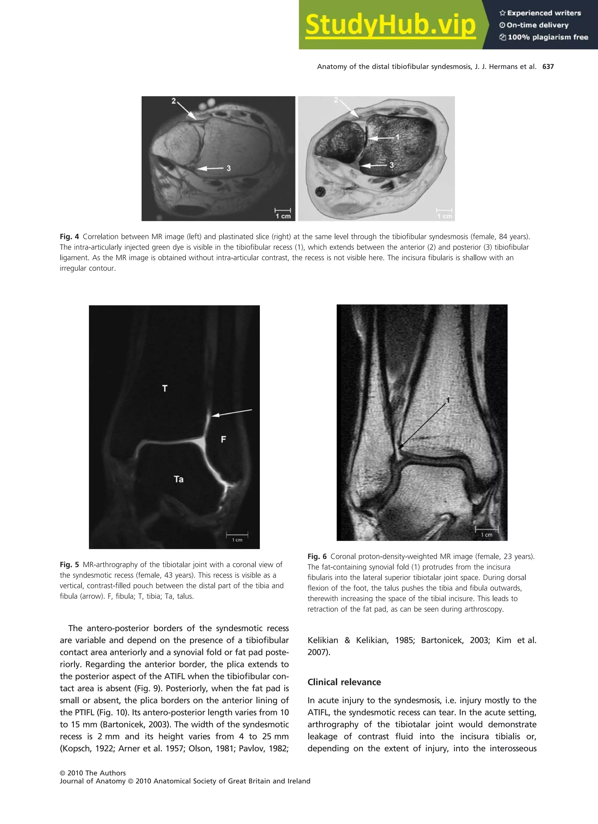 Anatomy Of The Distal Tibiofibular Syndesmosis In Adults A Pictorial ...