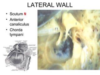 Scutum In Ear Anatomy of the external and middle ear | PPT