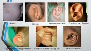 ANATOMY OF THE EXTERNAL EAR.pptx . | PPTX