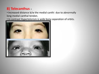 Anatomy of the eyelids. | PPTX