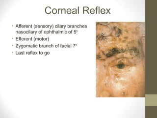 Corneal Reflex
• Afferent (sensory) cilary branches
nasocilary of ophthalmic of 5th
• Efferent (motor)
• Zygomatic branch of facial 7th
• Last reflex to go
 