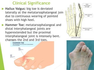 Hallux Digit ANATOMY OF THE FOOT AND ARCHES OF THE FOOT | PDF