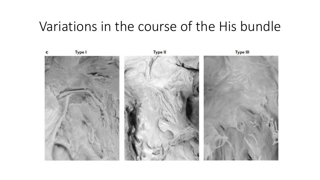 Anatomy of the his bundle