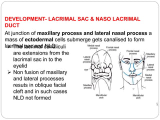 DEVELOPMENT- LACRIMAL SAC & NASO LACRIMAL
DUCT
At junction of maxillary process and lateral nasal process a
mass of ectodermal cells submerge gets canalised to form
lacrimal sac and NLD. The lacrimal canaliculi
are extensions from the
lacrimal sac in to the
eyelid
 Non fusion of maxillary
and lateral processes
resuts in oblique facial
cleft and in such cases
NLD not formed
 