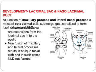 DEVELOPMENT- LACRIMAL SAC & NASO LACRIMAL
DUCT
At junction of maxillary process and lateral nasal process a
mass of ectode...