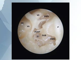 Anatomy of the middle ear | PPT