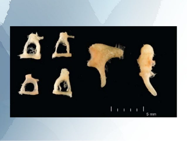 Anatomy of the middle ear
