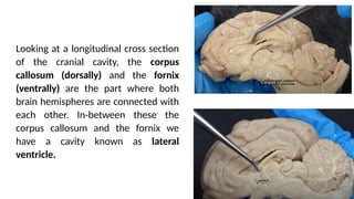 ANATOMY OF THE NERVOUS SYSTEM_part 2_11_05_2025.pptx