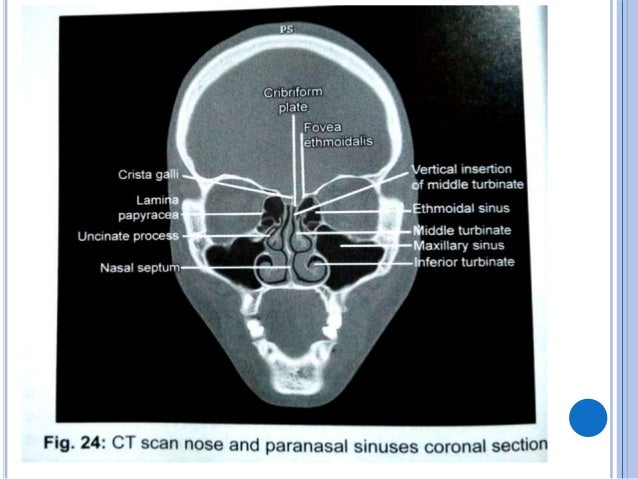 Anatomy of the orbit