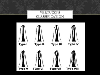 Vertuc Classification Anatomy of the pulp space and access cavity | PPTX