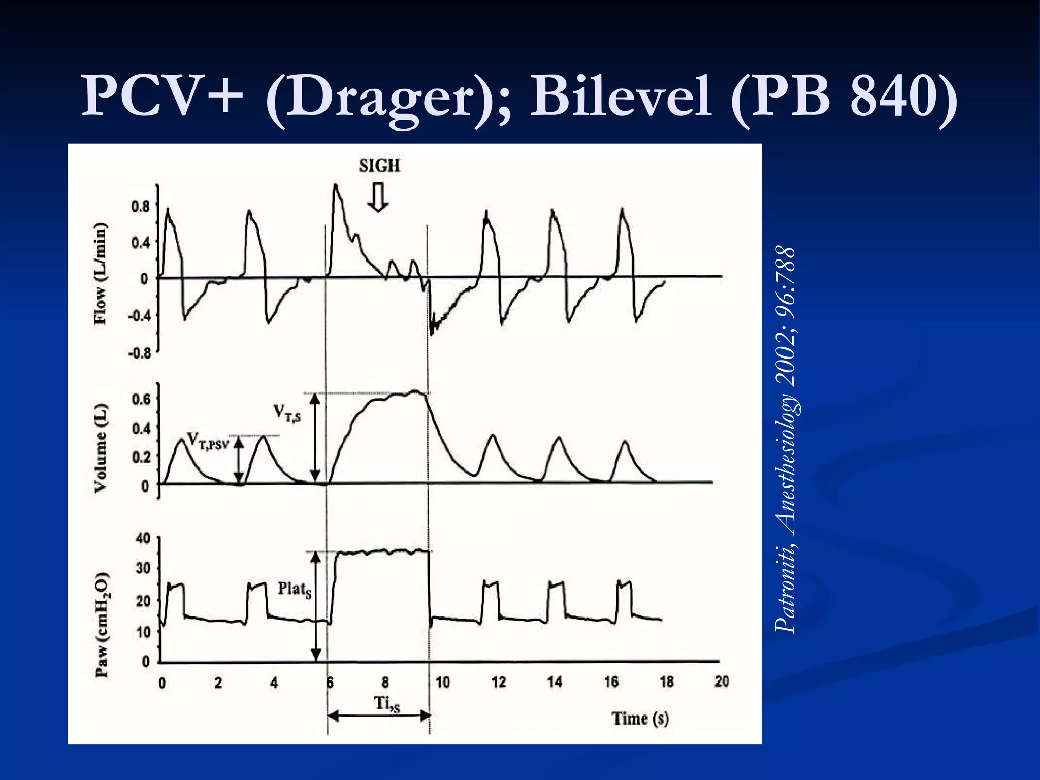 Anatomy of the ventilator | PPT