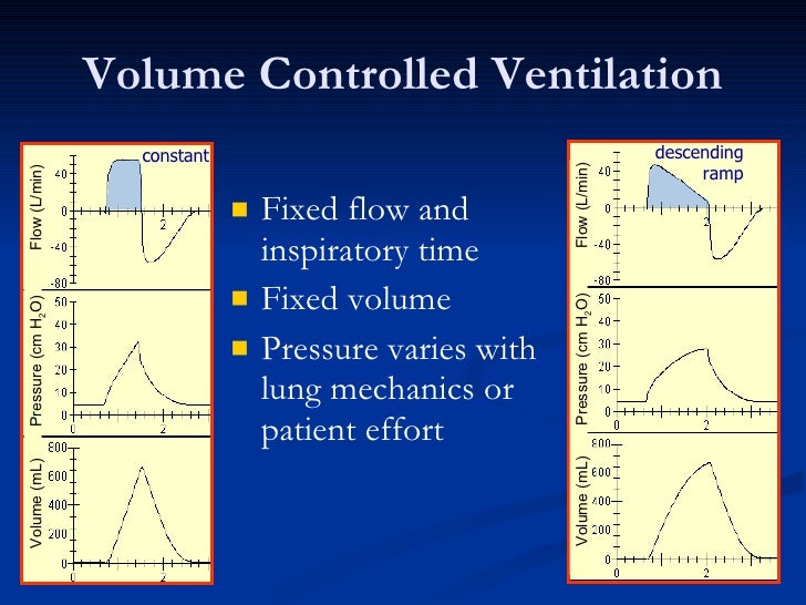 Anatomy of the ventilator