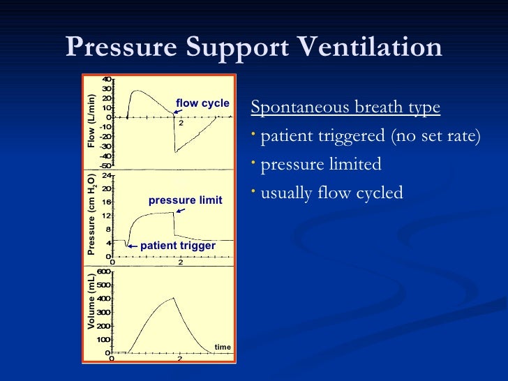 Anatomy of the ventilator