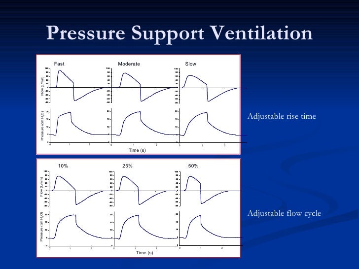 Anatomy of the ventilator