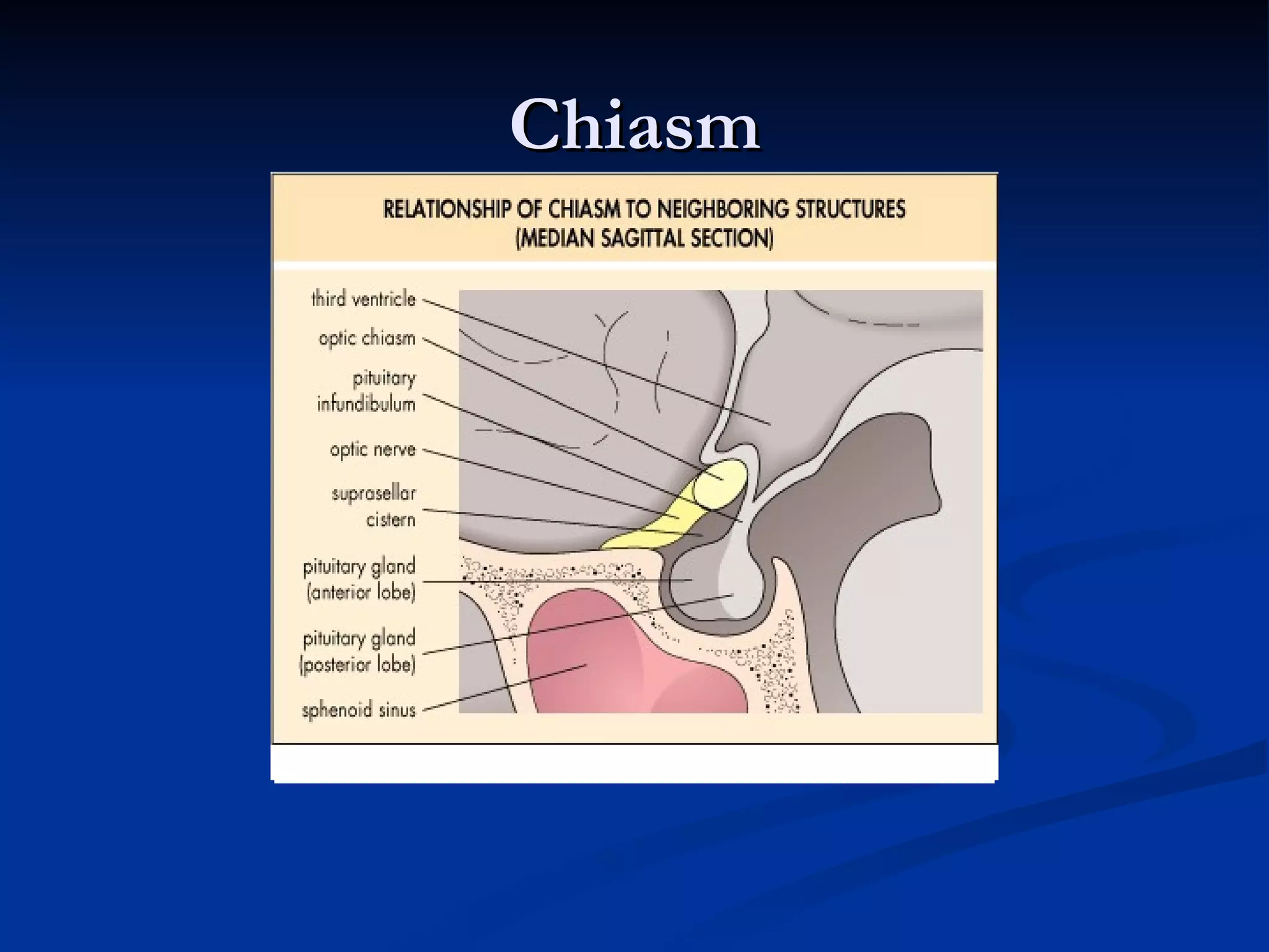 Chiasm
 