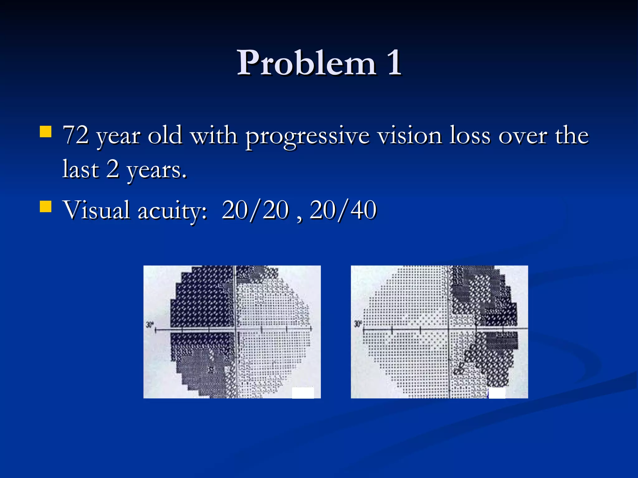 Problem 1
   72 year old with progressive vision loss over the
    last 2 years.
   Visual acuity: 20/20 , 20/40
 
