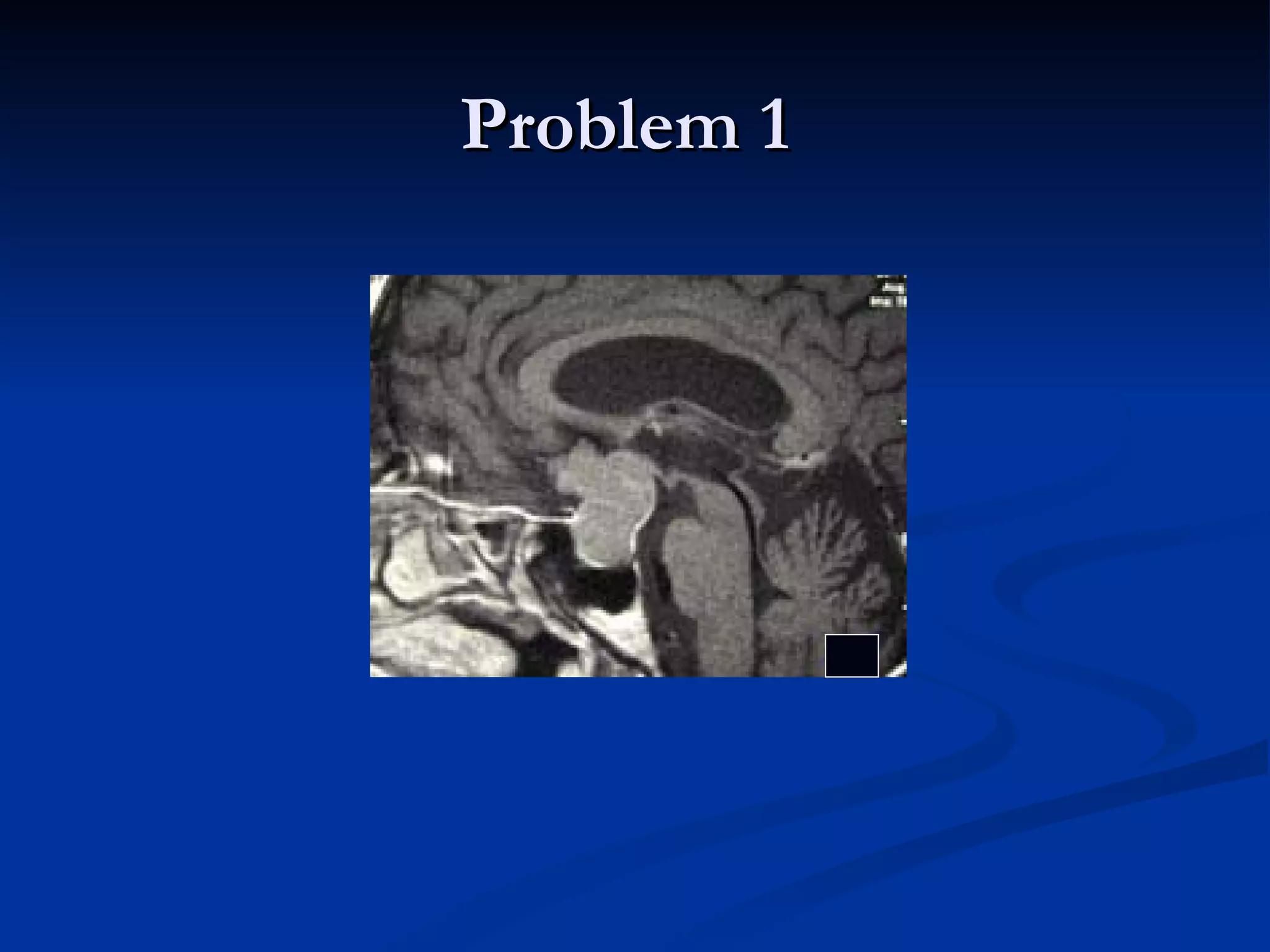 Problem 1
 