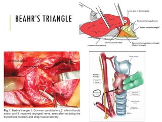 Beghelli Triangle ANATOMY AND PHYSIOLOGY OF THYROID GLAND / TRIANGLEs RELATED TO THYROID ...