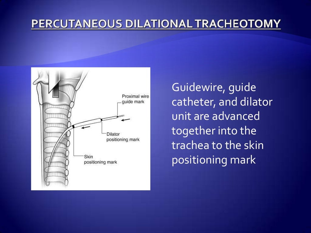 ANATOMY OF TRACHEA & TRACHEOSTOMY