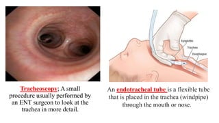 tukey's test for post hoc analysis