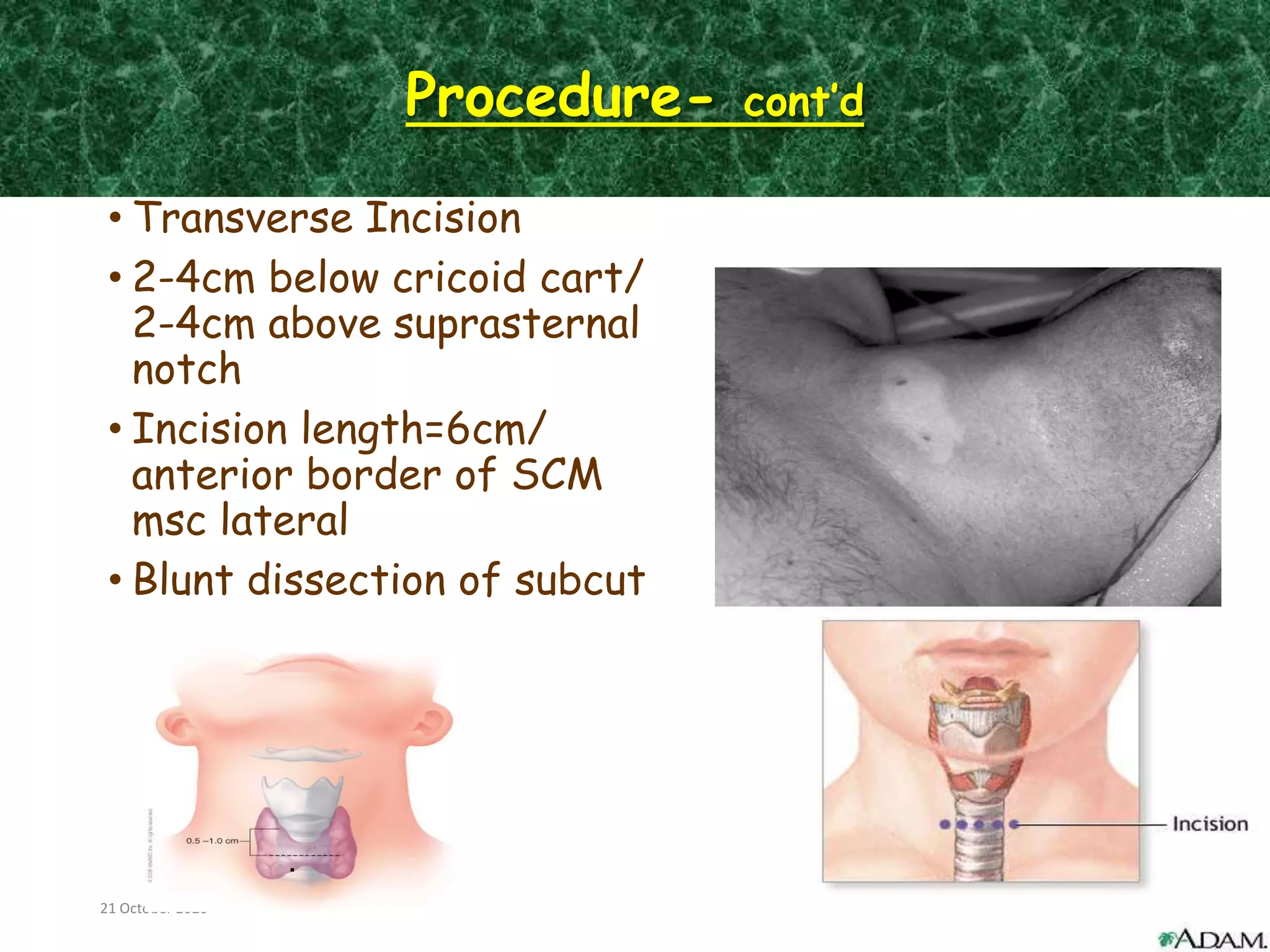 Anatomy of trachea & tracheostomy ----- | PPT