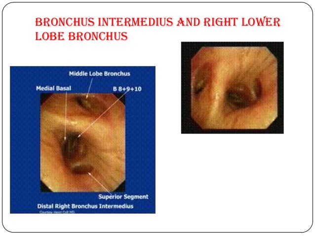 Anatomy of tracheobronchial tree