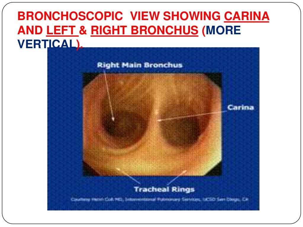 Anatomy of tracheobronchial tree