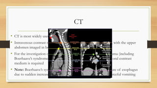 Comprehensive Radiological Anatomy of the Upper Gastrointestinal Tract ...