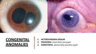 Polykorie anatomyofuvea , iris , ciliary body , choroid | PPTX