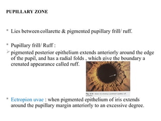 Anatomy of uvea and mechanism of uveitis.ppt