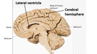 Genu Splenum ANATOMY OF VENTRICLES OF BRAIN | PPTX