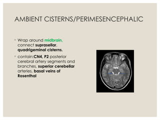 Comprehensive Anatomy of the Ventricular System and Subarachnoid ...