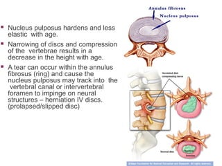 Pulpus Anatomy of Vertebral Column and Spinal Cord.ppt