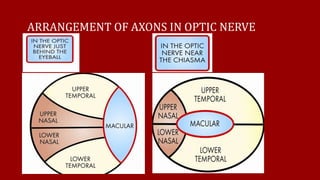 ARRANGEMENT OF AXONS IN OPTIC NERVE
 