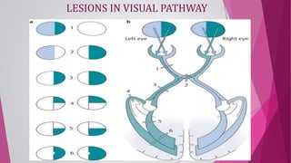 ANATOMY OF VISUAL PATHWAY - DR.RUTHRA.pptx