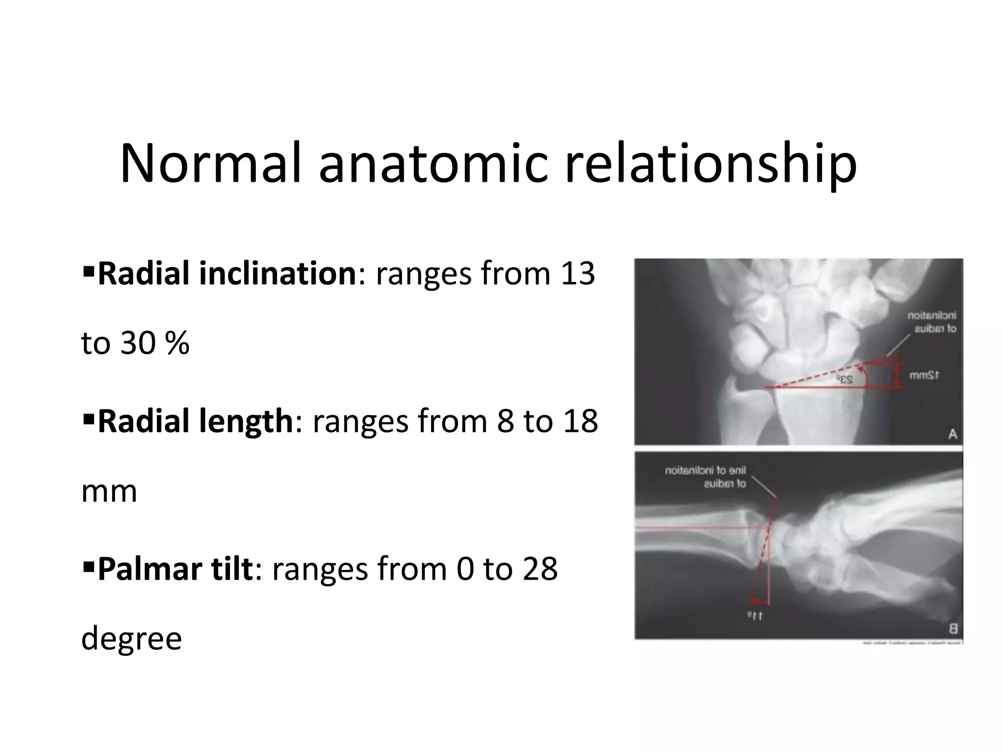 Anatomy of wrist joint | PPTX