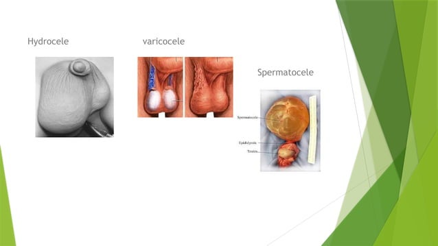 ANATOMY ON SCROTUM Easy Way To Learn This Just Download pptx anatomy-on-scrotum-easy-way-to-learn-this-just-download-pptx
