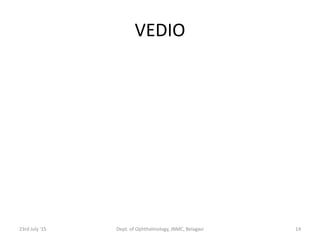 VEDIO
23rd July '15 Dept. of Ophthalmology, JNMC, Belagavi 14
 