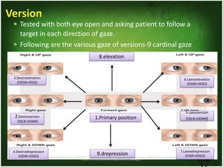 Dept. of Ophthalmology, JNMC, Belagavi
37
Version
 Tested with both eye open and asking patient to follow a
target in each direction of gaze.
 Following are the various gaze of versions-9 cardinal gaze
3.Dextroelevation
(ODSR+OSIO)
2.Destroversion
ODLR+OSMR)
5.Laevoversion
(OSLR+ODMR)
6.Laevoelevation
(OSSR+ODIO)
7.Laevodrepression
(OSIR+ODSO)9.drepression
8.elevation
1.Primary position
4.Dextrodrepression
(ODIR+OSSO)
 