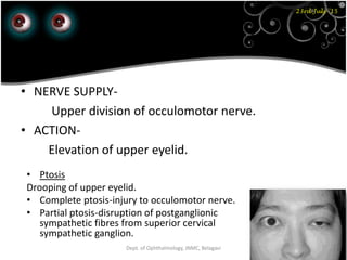 23rd July '15
2
• NERVE SUPPLY-
Upper division of occulomotor nerve.
• ACTION-
Elevation of upper eyelid.
• Ptosis
Drooping of upper eyelid.
• Complete ptosis-injury to occulomotor nerve.
• Partial ptosis-disruption of postganglionic
sympathetic fibres from superior cervical
sympathetic ganglion.
Dept. of Ophthalmology, JNMC, Belagavi
 