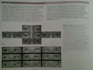 23rd July '15 Dept. of Ophthalmology, JNMC, Belagavi 46
 