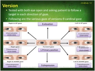 Dept. of Ophthalmology, JNMC, Belagavi
59
23rdJuly '15
Version
 Tested with both eye open and asking patient to follow a
target in each direction of gaze.
 Following are the various gaze of versions-9 cardinal gaze
3.Dextroelevation
(ODSR+OSIO)
2.Destroversion
ODLR+OSMR)
5.Laevoversion
(OSLR+ODMR)
6.Laevoelevation
(OSSR+ODIO)
7.Laevodrepression
(OSIR+ODSO)9.drepression
8.elevation
1.Primary position
4.Dextrodrepression
(ODIR+OSSO)
 