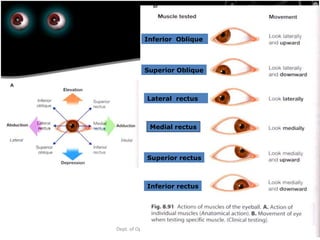 23rd July '15
64Dept. of Ophthalmology, JNMC, Belagavi
Superior Oblique
Inferior Oblique
Superior rectus
Inferior rectus
Medial rectus
Lateral rectus
 